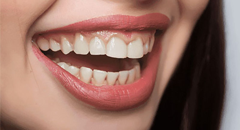 Top Rated Riverside Ca Dentist Smile Advantage Riverside Ca