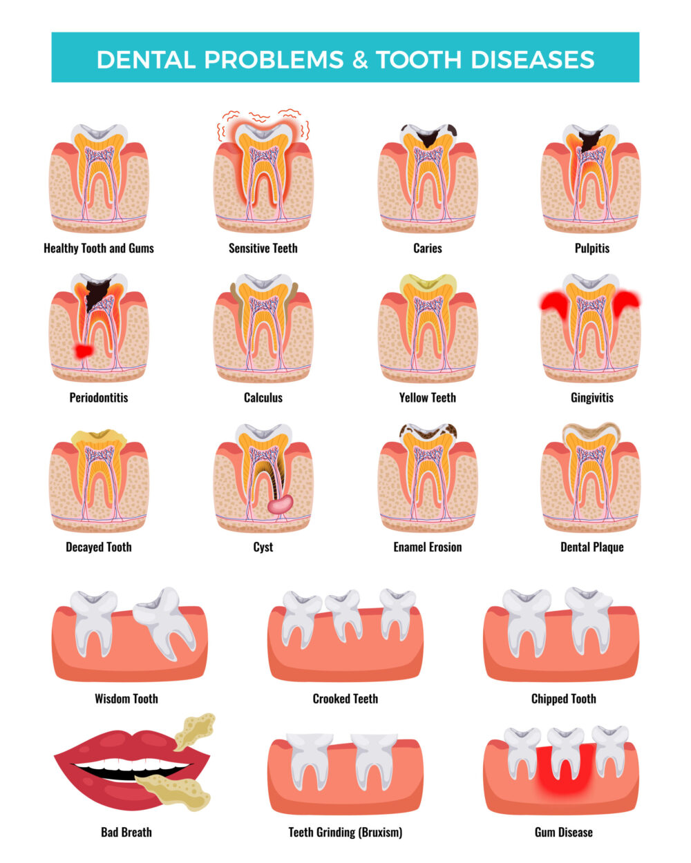 dental diseasees